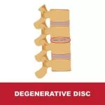 degeneration-disc-disease
